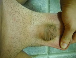 Small penis collection Image 6