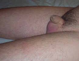 Men with tiny cocks gallery Image 5