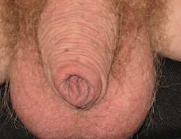 My small cock locked in chastity gellery Image 1