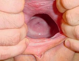 Deep fisting gallery Image 4