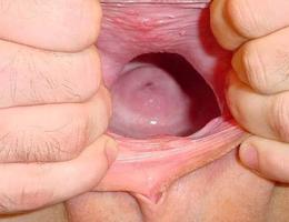Nice teen fisting images Image 5