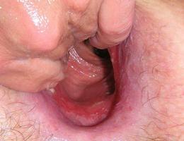 Amateur fisting party images Image 5