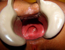 Anal fisting pics Image 7