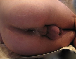 Gaping, fisting and prolapsing collection Image 5