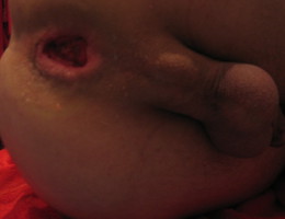 Women fisting males images Image 1
