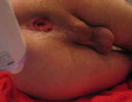 My girl fisting my asshole shots Image 3