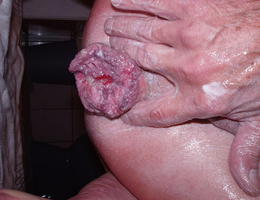 The top ten gay fisting galery Image 2