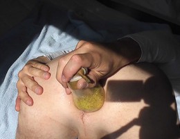 Extreme fisting amateurs gall Image 1