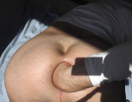 Fisting anal and more series Image 3