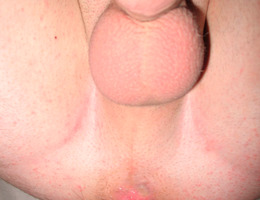The top ten gay fisting gallery Image 3