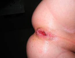 Self gay anal fisting gall Image 6