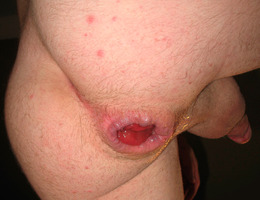 Women fisting males photos Image 7