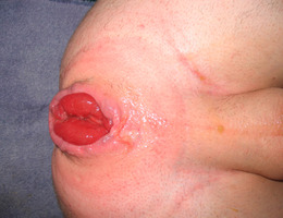 Fisting anal and more gelery Image 4