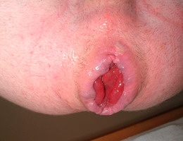 This is a first time fisting gay pics Image 7