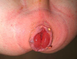 More juicy gay anal fisting series Image 6