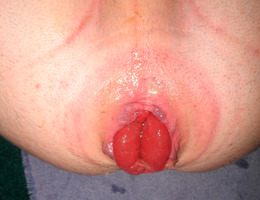 More juicy gay anal fisting series Image 7