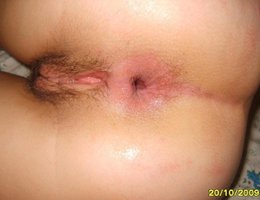 Anal fun images Image 2