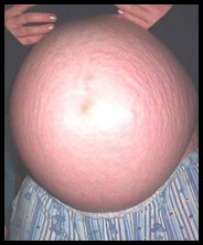 pregnant_girlfriends2_000716.jpg