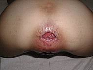 analgape06.jpg