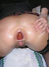 analgape125.jpg