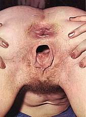 pussygape81.jpg