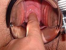 speculum36.jpg
