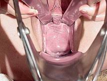 speculum31.jpg