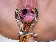 speculum69.jpg