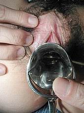 speculum44.jpg