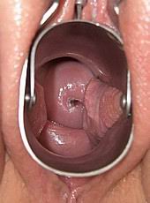 speculum46.jpg