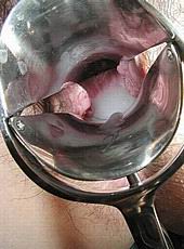 speculum49.jpg