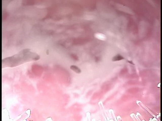 pussy scope