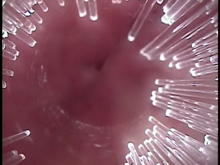 pussy scope