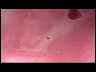 pussy scope