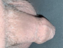 Small cock, new images Image 7