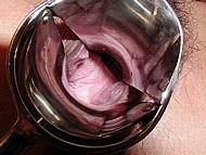speculum20.jpg