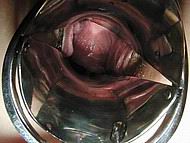 speculum22.jpg